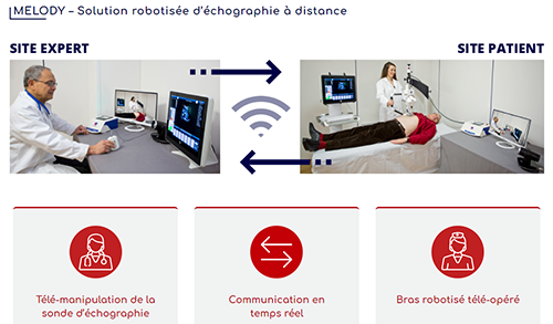 Schéma du fonctionnement de la télé-échographie 